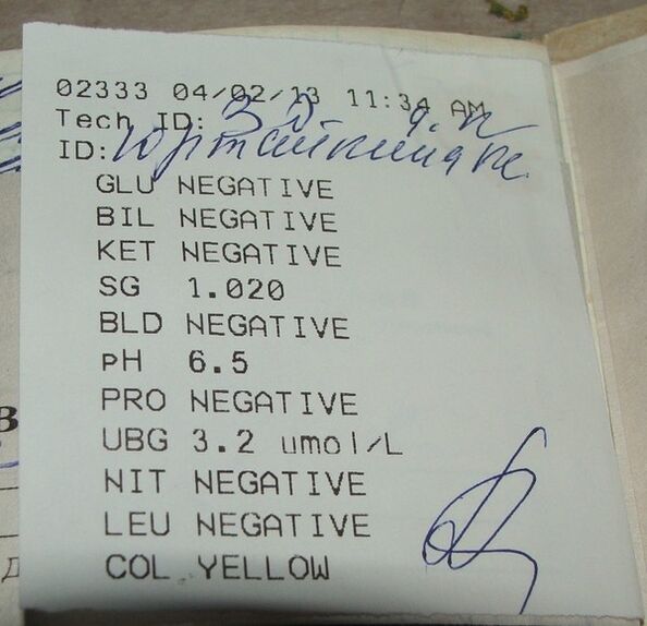 Η ανάλυση των ούρων μου προκύπτει πριν από το femixal